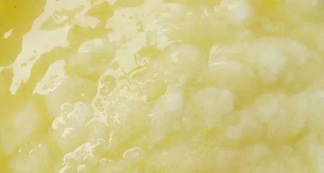 蜂王浆每天吃多少合适