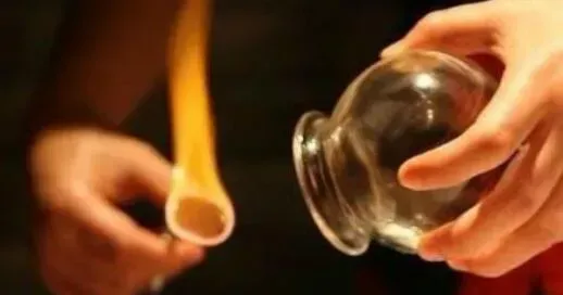 拔火罐的好处和坏处 拔火罐要注意什么